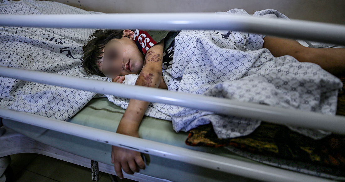 Un Niño Palestino Que Resultó Herido En Ataques Aéreos Israelíes Yace En El Hospital Al shifa En La Ciudad De Gaza